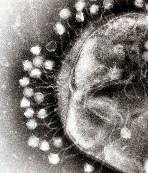 photographie virus bacteriophages au microscope electronique