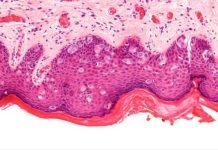 « Octobre rose » ou la non-politique du sein